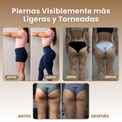 GLENDALEG® 2026 – Legging de Compresión Graduada con Micro-Masaje 3D, di adiós a la celulitis y reafirma tus piernas y glúteos (resultados visibles en 7 días)
