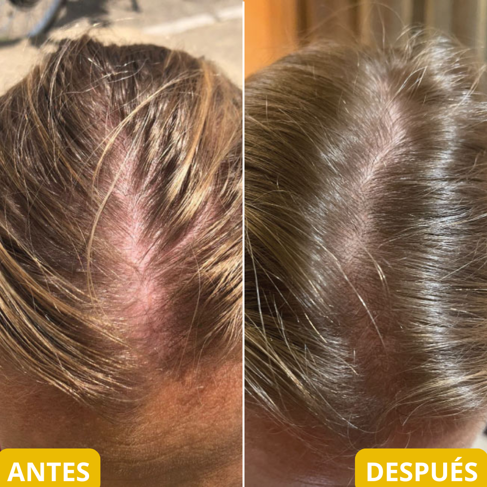 <p>Resultados reales en Mujeres reales… +35.000 <strong>Testimonios Verificados lo Respaldan</strong></p>